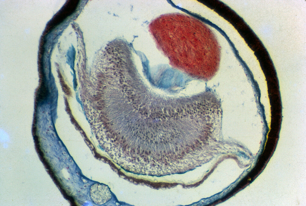 Section through Eye of Scaeochlamys lividus