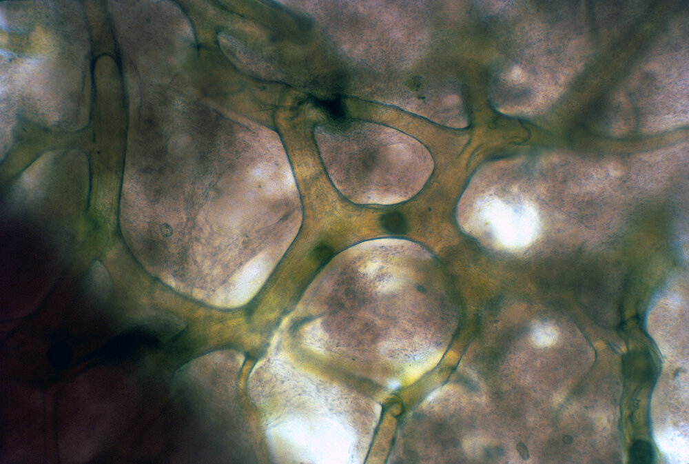 Keratosa under magnification