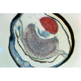 Section through Eye of Scaeochlamys lividus