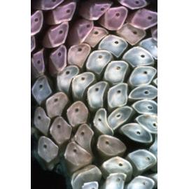 Egg Capsules of Dicathais orbita, 1965