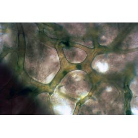 Keratosa under magnification